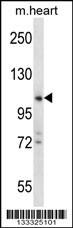 ZCCHC14 Antibody