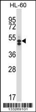 HDAC7 Antibody