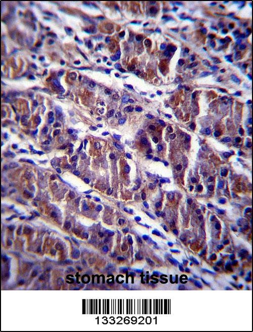 HDAC7 Antibody