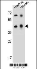 ADAL Antibody