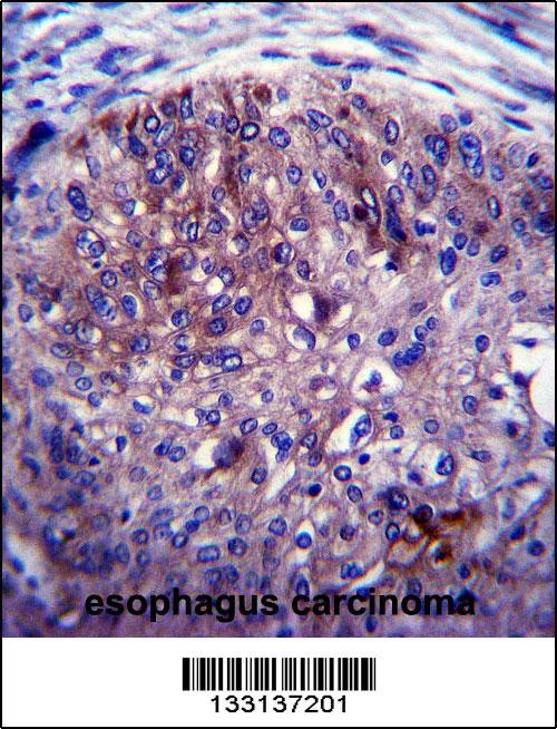 ADAL Antibody