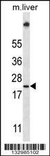 UBE2W Antibody