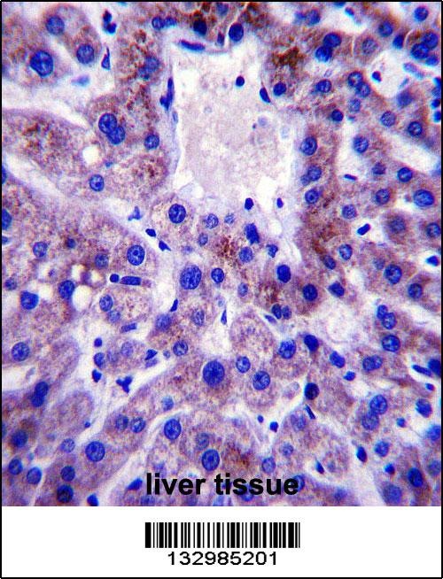 UBE2W Antibody