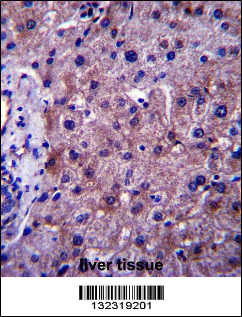 SGMS1 Antibody