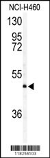AIFM2 Antibody