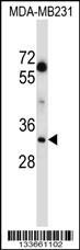 LDHA Antibody