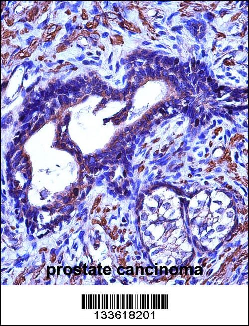 ACTG2 Antibody