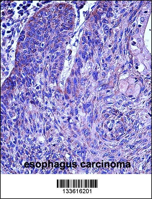 MMP3 Antibody