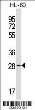 ZDHHC24 Antibody