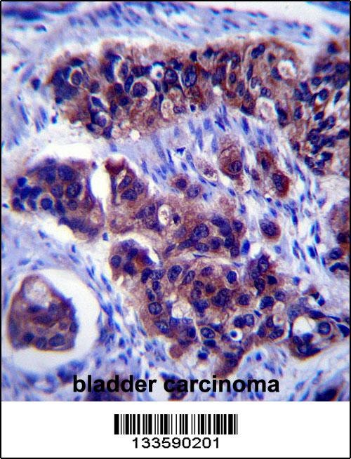 ZDHHC24 Antibody