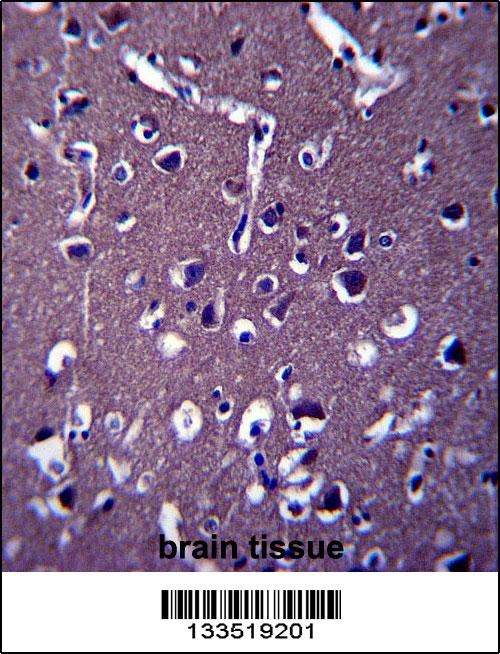 ZSWIM5 Antibody