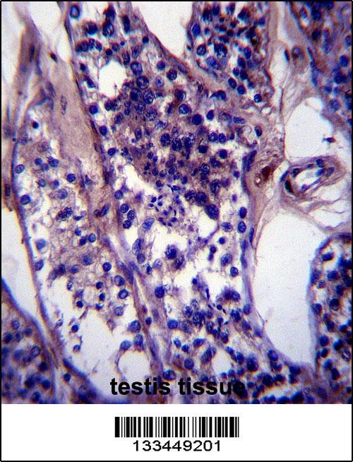 CCDC99 Antibody