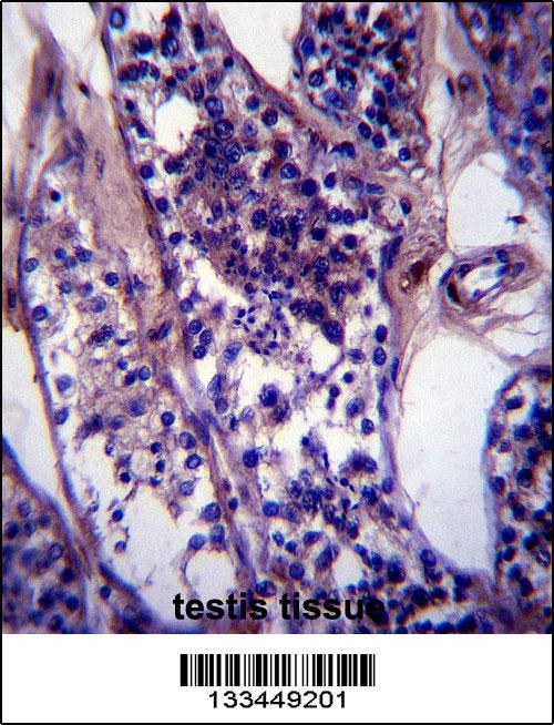 SPDL1 Antibody