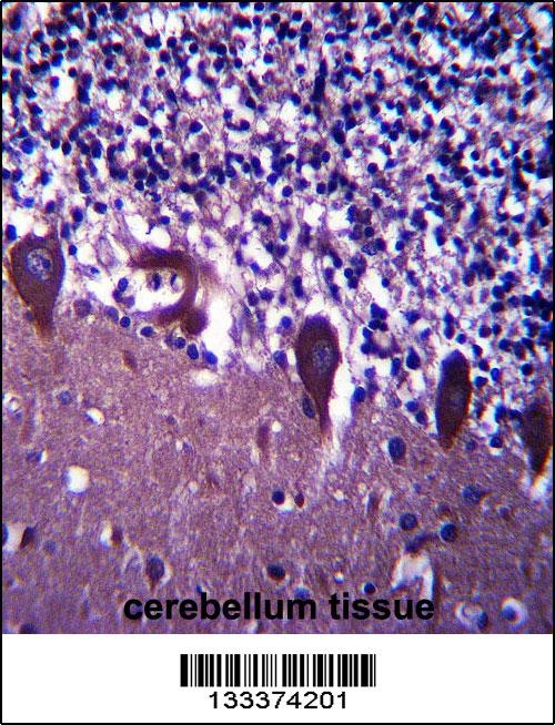 TLE6 Antibody