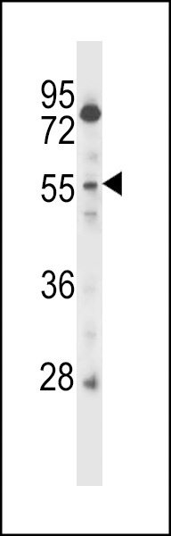 CSRNP2 Antibody