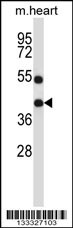 DTX3 Antibody