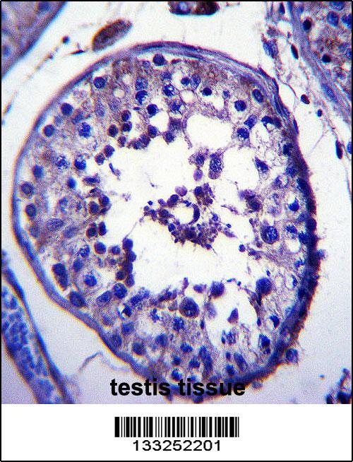 TRIM39 Antibody