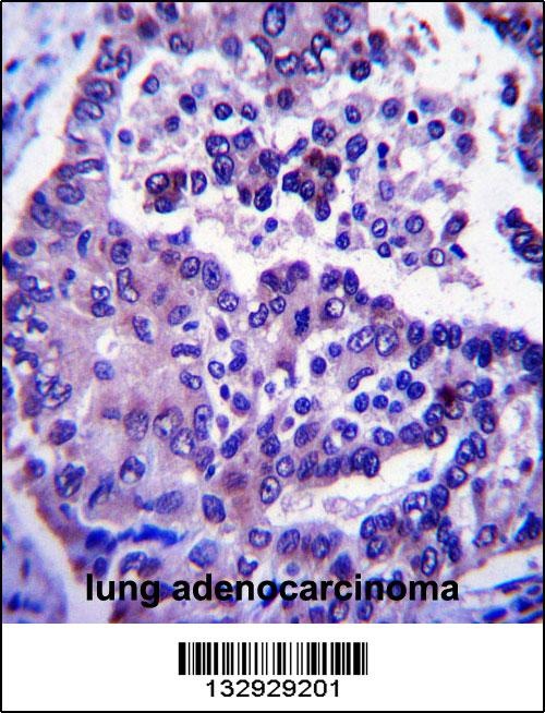 ARL8A Antibody