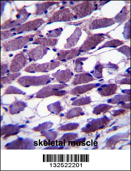 MYOM1 Antibody