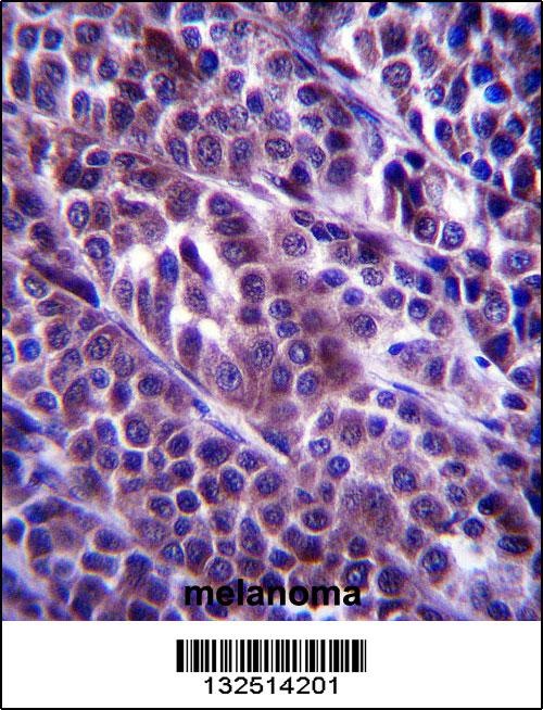 ARMC9 Antibody