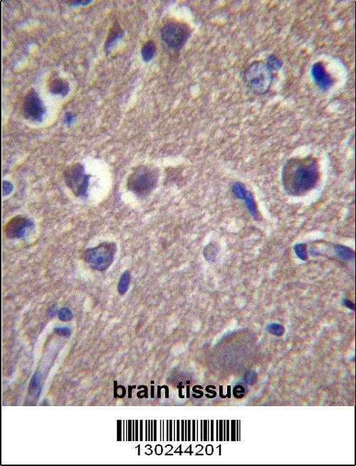 ANKS1B Antibody