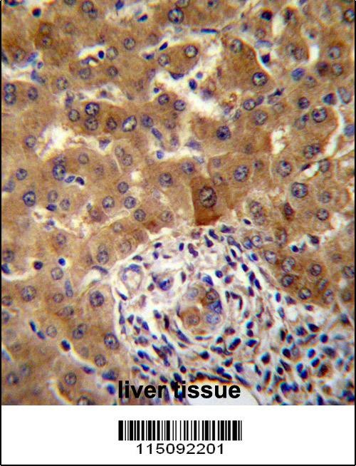 PHF17 Antibody