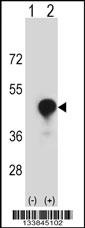 CD1C Antibody