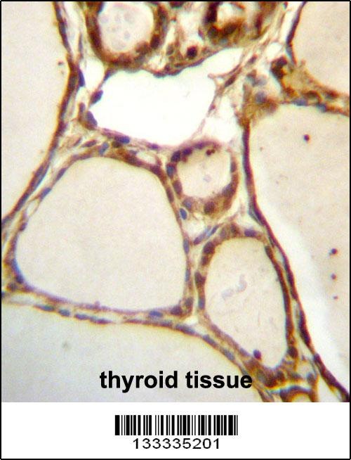 HJURP Antibody