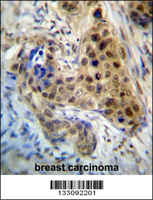 RPL3 Antibody