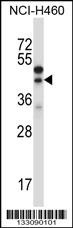 CTGF Antibody