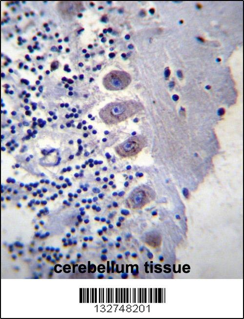 BEAN1 Antibody