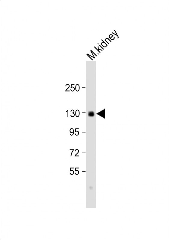 CACNA2D2 Antibody