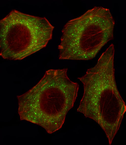 CACNA2D2 Antibody