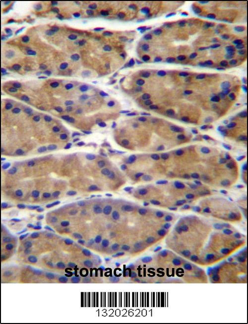 UPRT Antibody