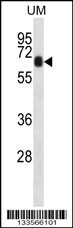 CCDC120 Antibody