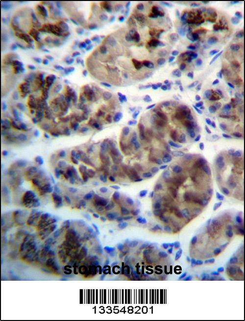 ZDHHC20 Antibody