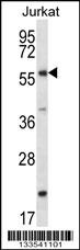 FOXJ3 Antibody
