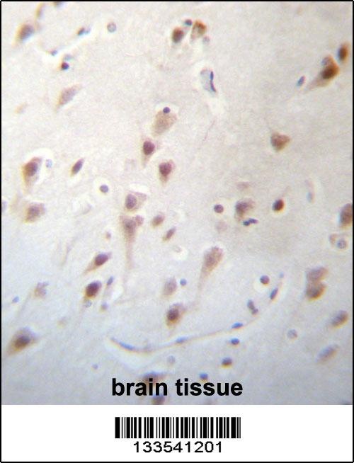 FOXJ3 Antibody