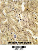 HSP40 Antibody