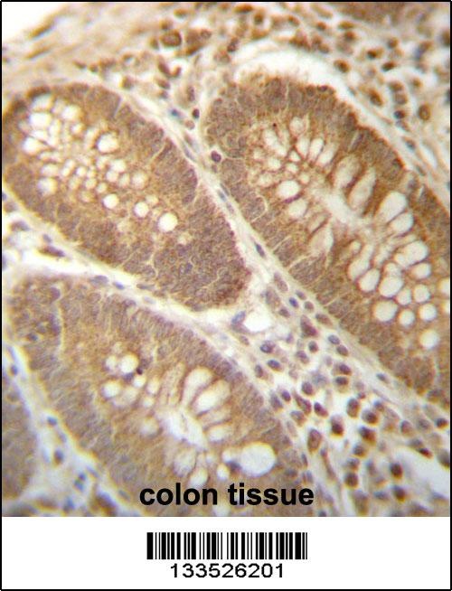 PGAM4 Antibody