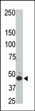 HtrA3 Antibody