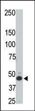 HTRA3 Antibody