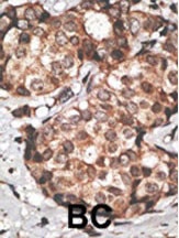 HtrA3 Antibody