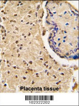 HTRA3 Antibody