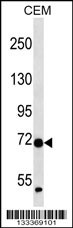 ZNF443 Antibody