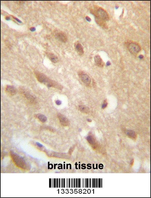 YAE1D1 Antibody