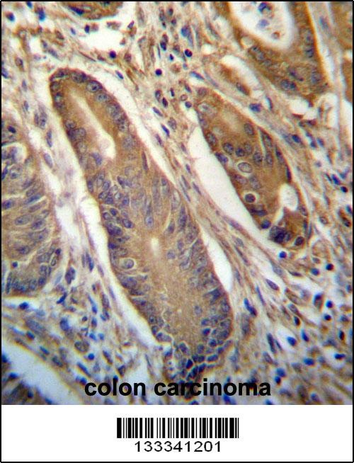 NETO2 Antibody