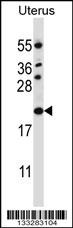 CDKN1B Antibody