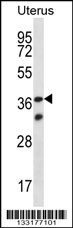 OR4X2 Antibody