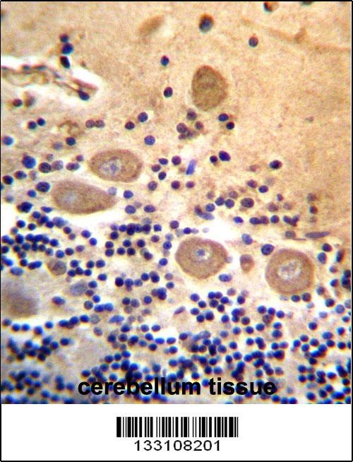 RTDR1 Antibody